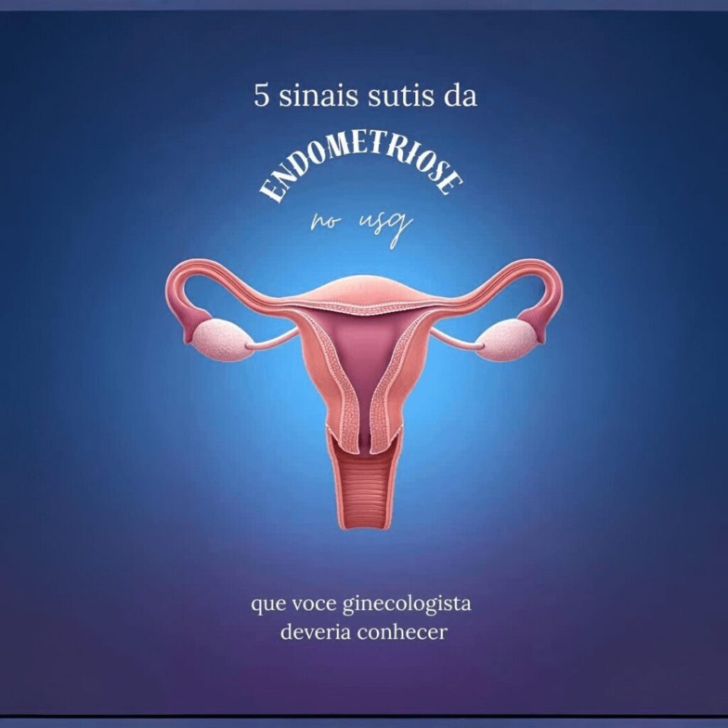 5 sinais sutis de endometriose no usg